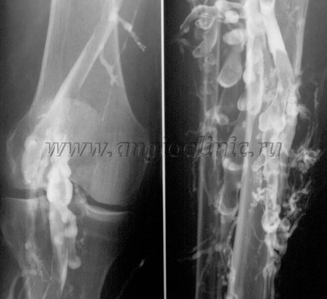 الفحص بالموجات فوق الصوتية